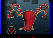 UterusInsideOutside for Mac logo