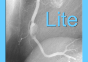 CARDIO3® Atlas of Interventional Cardiology - Lite for Mac logo
